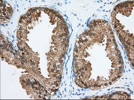 ACAT2 Antibody - IHC of paraffin-embedded Human prostate tissue using anti-ACAT2 mouse monoclonal antibody. (Dilution 1:50).