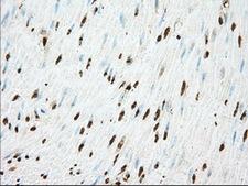 ACAT2 Antibody - IHC of paraffin-embedded Human colon tissue using anti-ACAT2 mouse monoclonal antibody. (Dilution 1:50).