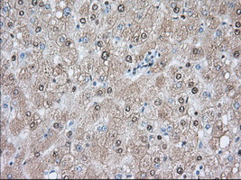 ACAT2 Antibody - IHC of paraffin-embedded Human liver tissue using anti-ACAT2 mouse monoclonal antibody. (Dilution 1:50).