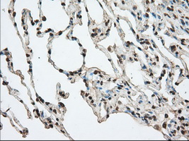 ACAT2 Antibody - IHC of paraffin-embedded Human lung tissue using anti-ACAT2 mouse monoclonal antibody. (Dilution 1:50).