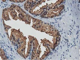 ACAT2 Antibody - IHC of paraffin-embedded Human prostate tissue using anti-ACAT2 mouse monoclonal antibody.