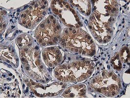 ACAT2 Antibody - IHC of paraffin-embedded Human Kidney tissue using anti-ACAT2 mouse monoclonal antibody.