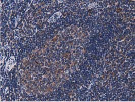 ACAT2 Antibody - IHC of paraffin-embedded Human lymph node tissue using anti-ACAT2 mouse monoclonal antibody.