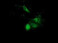 ACAT2 Antibody - Anti-ACAT2 mouse monoclonal antibody immunofluorescent staining of COS7 cells transiently transfected by pCMV6-ENTRY ACAT2.