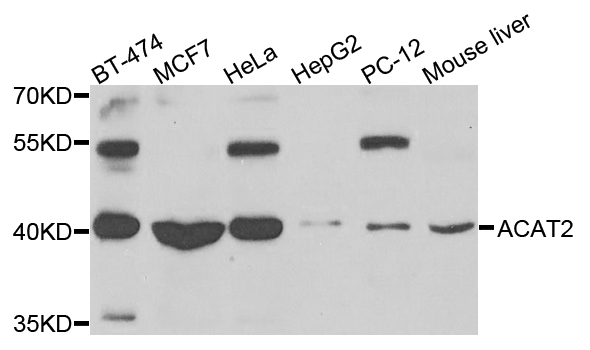 ACAT2 Antibody - Western blot analysis of extracts of various cells.