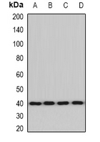 ACAT2 Antibody - Western blot analysis of ACAT2 expression in MCF7 (A); HepG2 (B); PC12 (C); mouse liver (D) whole cell lysates.