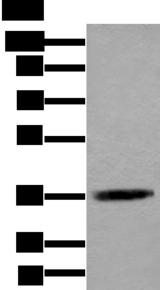ACAT2 Antibody - Western blot analysis of Jurkat cell lysate  using ACAT2 Polyclonal Antibody at dilution of 1:550