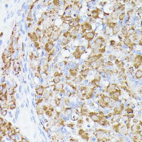 ACAT2 Antibody - Immunohistochemistry of paraffin-embedded Rat ovary using ACAT2 Polyclonal Antibody at dilution of 1:100 (40x lens).