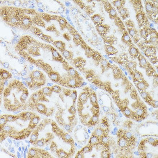 ACAT2 Antibody - Immunohistochemistry of paraffin-embedded Mouse kidney using ACAT2 Polyclonal Antibody at dilution of 1:100 (40x lens).