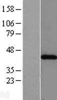 ACAT2 Protein - Western validation with an anti-DDK antibody * L: Control HEK293 lysate R: Over-expression lysate