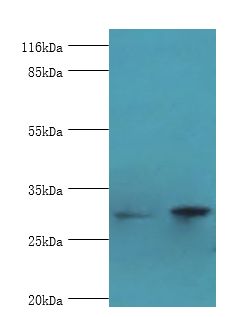 ACBD4 Antibody - Western blot. All lanes: ACBD4 antibody at 2 ug/ml Lane 1:mouse kidney tissue. Lane 2: mouse liver tissue. Secondary antibody: Goat polyclonal to rabbit at 1:10000 dilution. Predicted band size: 30 kDa. Observed band size: 30 kDa.  This image was taken for the unconjugated form of this product. Other forms have not been tested.
