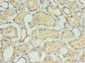 ACBD4 Antibody - Immunohistochemistry of paraffin-embedded human kidney using antibody at 1:100 dilution.  This image was taken for the unconjugated form of this product. Other forms have not been tested.
