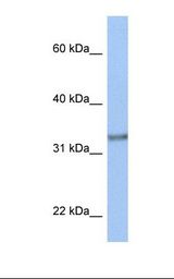 ACBD4 Antibody - MCF7 cell lysate. Antibody concentration: 1.0 ug/ml. Gel concentration: 12%.  This image was taken for the unconjugated form of this product. Other forms have not been tested.