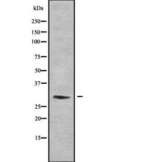 ACBD4 Antibody - Western blot analysis of ACBD4 using HeLa whole cells lysates