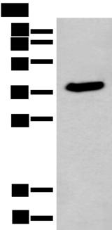 ACBD4 Antibody - Western blot analysis of HEPG2 cell lysate  using ACBD4 Polyclonal Antibody at dilution of 1:400