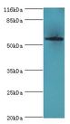 ACBD5 Antibody - Western blot. All lanes: ACBD5 antibody at 2 ug/ml+HeLa whole cell lysate. Secondary antibody: Goat polyclonal to rabbit at 1:10000 dilution. Predicted band size: 60 kDa. Observed band size: 60 kDa.  This image was taken for the unconjugated form of this product. Other forms have not been tested.