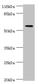 ACBD5 Antibody - Western blot All lanes: ACBD5 antibody at 2µg/ml + Hela whole cell lysate Secondary Goat polyclonal to rabbit IgG at 1/10000 dilution Predicted band size: 61, 55, 59, 47 kDa Observed band size: 61 kDa