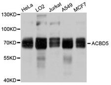 ACBD5 Antibody - Western blot analysis of extracts of various cell lines, using ACBD5 antibody at 1:1000 dilution. The secondary antibody used was an HRP Goat Anti-Rabbit IgG (H+L) at 1:10000 dilution. Lysates were loaded 25ug per lane and 3% nonfat dry milk in TBST was used for blocking. An ECL Kit was used for detection and the exposure time was 1s.