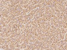 ACBD5 Antibody - Immunochemical staining of human ACBD5 in human liver with rabbit polyclonal antibody at 1:100 dilution, formalin-fixed paraffin embedded sections.