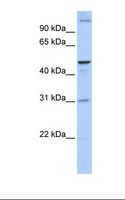 ACBD5 Antibody - Fetal brain lysate. Antibody concentration: 1.0 ug/ml. Gel concentration: 12%.  This image was taken for the unconjugated form of this product. Other forms have not been tested.