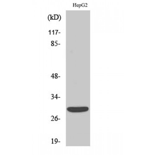 ACBD6 Antibody - Western blot of ACBD6 antibody