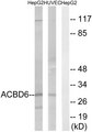 ACBD6 Antibody - Western blot analysis of lysates from HepG2 and HUVEC cells, using ACBD6 Antibody. The lane on the right is blocked with the synthesized peptide.
