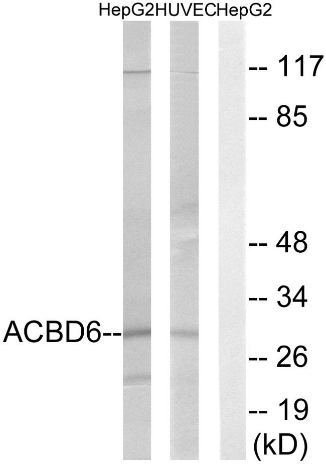 ACBD6 Antibody - Western blot analysis of lysates from HepG2 and HUVEC cells, using ACBD6 Antibody. The lane on the right is blocked with the synthesized peptide.