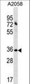ACBD6 Antibody - ACBD6 Antibody western blot of A2058 cell line lysates (35 ug/lane). The ACBD6 antibody detected the ACBD6 protein (arrow).