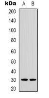 ACBD6 Antibody - Western blot analysis of ACBD6 expression in HepG2 (A); U251 (B) whole cell lysates.