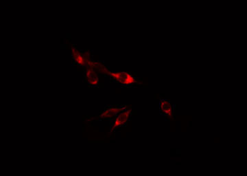 ACBD6 Antibody - Staining HepG2 cells by IF/ICC. The samples were fixed with PFA and permeabilized in 0.1% Triton X-100, then blocked in 10% serum for 45 min at 25°C. The primary antibody was diluted at 1:200 and incubated with the sample for 1 hour at 37°C. An Alexa Fluor 594 conjugated goat anti-rabbit IgG (H+L) antibody, diluted at 1/600, was used as secondary antibody.