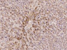ACBD6 Antibody - Immunochemical staining of human ACBD6 in human liver with rabbit polyclonal antibody at 1:100 dilution, formalin-fixed paraffin embedded sections.