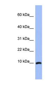 ACBD7 Antibody - ACBD7 antibody Western blot of Fetal Brain lysate. This image was taken for the unconjugated form of this product. Other forms have not been tested.