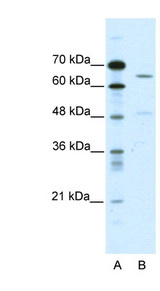 ACCN1 / ASIC2 Antibody - ACCN1 antibody Western blot of HepG2 cell lysate. This image was taken for the unconjugated form of this product. Other forms have not been tested.