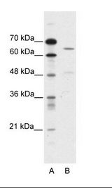 ACCN1 / ASIC2 Antibody - A: Marker, B: HepG2 Cell Lysate.  This image was taken for the unconjugated form of this product. Other forms have not been tested.