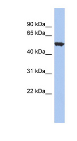 ACCN1 / ASIC2 Antibody - ACCN1 antibody Western blot of THP-1 cell lysate. This image was taken for the unconjugated form of this product. Other forms have not been tested.