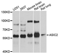 ACCN1 / ASIC2 Antibody - Western blot analysis of extracts of various cell lines, using ASIC2 antibody at 1:1000 dilution. The secondary antibody used was an HRP Goat Anti-Rabbit IgG (H+L) at 1:10000 dilution. Lysates were loaded 25ug per lane and 3% nonfat dry milk in TBST was used for blocking. An ECL Kit was used for detection and the exposure time was 10s.