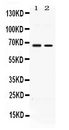 ACCN1 / ASIC2 Antibody - Western blot - Anti-ACCN1 Picoband Antibody