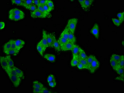 ACCN1 / ASIC2 Antibody - Immunofluorescence staining of HepG2 cells at a dilution of 1:100, counter-stained with DAPI. The cells were fixed in 4% formaldehyde, permeabilized using 0.2% Triton X-100 and blocked in 10% normal Goat Serum. The cells were then incubated with the antibody overnight at 4 °C.The secondary antibody was Alexa Fluor 488-congugated AffiniPure Goat Anti-Rabbit IgG (H+L) .