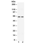 ACCN1 / ASIC2 Antibody - Western blot testing of 1) rat testis and 2) human MCF7 lysate with ACCN1 antibody at 0.5ug/ml. Predicted molecular weight ~58 kDa.
