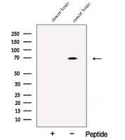 ACCN1 / ASIC2 Antibody - Western blot analysis of extracts of mouse brain tissue using ASIC2 antibody. The lane on the left was treated with blocking peptide.