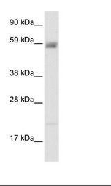 ACCN3 / ASIC3 Antibody - Fetal Kidney Lysate.  This image was taken for the unconjugated form of this product. Other forms have not been tested.