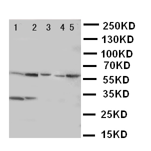 ACCN3 / ASIC3 Antibody - WB of ACCN3 / ASIC3 antibody. Lane 1: Rat Brain Tissue Lysate. Lane 2: Rat Testis Tissue Lysate. Lane 3: U87 Cell Lysate. Lane 4: NEURO Cell Lysate. Lane 5: SMMC Cell Lysate.