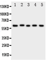 ACCN3 / ASIC3 Antibody - Western blot analysis of ASIC3 using anti-ASIC3 antibody. Electrophoresis was performed on a 5-20% SDS-PAGE gel at 70V (Stacking gel) / 90V (Resolving gel) for 2-3 hours. The sample well of each lane was loaded with 50ug of sample under reducing conditions. Lane 1: Rat Brain Tissue Lysate, Lane 2: Rat Testis Tissue Lysate, Lane 3: U87 Cell Lysate, Lane 4: NEURO Cell Lysate, Lane 5: SMMC Cell Lysate. After Electrophoresis, proteins were transferred to a Nitrocellulose membrane at 150mA for 50-90 minutes. Blocked the membrane with 5% Non-fat Milk/ TBS for 1.5 hour at RT. The membrane was incubated with rabbit anti-ASIC3 antigen affinity purified polyclonal antibody at 0.5 µg/mL overnight at 4°C, then washed with TBS-0.1% Tween 3 times with 5 minutes each and probed with a goat anti-rabbit IgG-HRP secondary antibody at a dilution of 1:10000 for 1.5 hour at RT. The signal is developed using an Enhanced Chemiluminescent detection (ECL) kit with Tanon 5200 system. A specific band was detected for ASIC3 at approximately 69KD. The expected band size for ASIC3 is at 58KD.