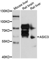 ACCN3 / ASIC3 Antibody - Western blot analysis of extracts of various cell lines, using ASIC3 antibody at 1:1000 dilution. The secondary antibody used was an HRP Goat Anti-Rabbit IgG (H+L) at 1:10000 dilution. Lysates were loaded 25ug per lane and 3% nonfat dry milk in TBST was used for blocking. An ECL Kit was used for detection and the exposure time was 60s.