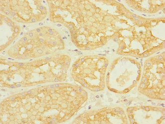 ACCN3 / ASIC3 Antibody - Immunohistochemistry of paraffin-embedded human kidney tissue at dilution 1:100