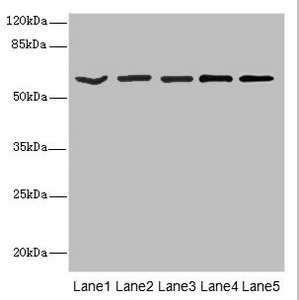 ACCN3 / ASIC3 Antibody - Western blot All Lanes: ASIC3 antibody at 2.4ug/ml Lane 1: Jurkat whole cell lysate Lane 2: HepG-2 whole cell lysate Lane 3: Hela whole cell lysate Lane 4: A549 whole cell lysate Lane 5: A431 whole cell lysate Secondary Goat polyclonal to rabbit IgG at 1/10000 dilution Predicted band size: 59,61,45 kDa Observed band size: 59 kDa
