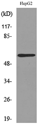 ACCN3 / ASIC3 Antibody - Western blot analysis of lysate from HepG2 cells, using ASIC3 Antibody.