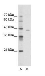 ACCN4 / ASIC4 Antibody - A: Marker, B: Jurkat Cell Lysate.  This image was taken for the unconjugated form of this product. Other forms have not been tested.