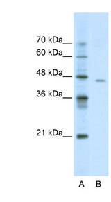 ACCN4 / ASIC4 Antibody - ACCN4 antibody Western blot of Jurkat lysate. This image was taken for the unconjugated form of this product. Other forms have not been tested.