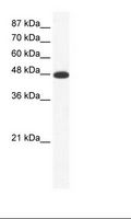 ACCN5 / HINAC Antibody - Jurkat Cell Lysate.  This image was taken for the unconjugated form of this product. Other forms have not been tested.